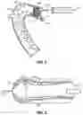 Fig. 02 - Eluting perfusion catheters and related methods