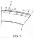 Fig. 02 - TEMPORARY OCCLUSION BALLOON DEVICES AND METHODS FOR PREVENTING BLOOD FLOW THROUGH A VASCULAR PERFORATION