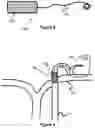 Fig. 04 - System And Method For Treatment Via Bodily Drainage Or Injection