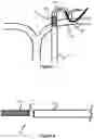 Fig. 05 - System And Method For Treatment Via Bodily Drainage Or Injection