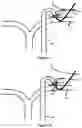 Fig. 07 - System And Method For Treatment Via Bodily Drainage Or Injection