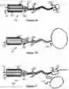 Fig. 09 - System And Method For Treatment Via Bodily Drainage Or Injection