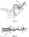 Fig. 10 - System And Method For Treatment Via Bodily Drainage Or Injection