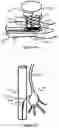 Fig. 12 - System And Method For Treatment Via Bodily Drainage Or Injection