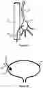 Fig. 13 - System And Method For Treatment Via Bodily Drainage Or Injection