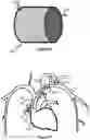 Fig. 14 - System And Method For Treatment Via Bodily Drainage Or Injection