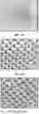 Fig. 09 - MICRONEEDLE ARRAY WITH ACTIVE INGREDIENT