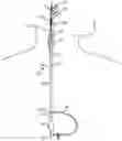 Fig. 01 - Systems and methods for treating a carotid artery