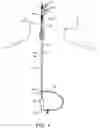 Fig. 02 - Systems and methods for treating a carotid artery