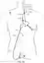 Fig. 04 - Systems and methods for treating a carotid artery