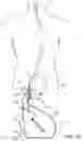 Fig. 05 - Systems and methods for treating a carotid artery
