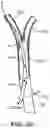 Fig. 08 - Systems and methods for treating a carotid artery