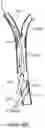 Fig. 09 - Systems and methods for treating a carotid artery