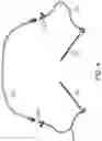 Fig. 10 - Systems and methods for treating a carotid artery