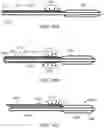 Fig. 103 - Systems and methods for treating a carotid artery