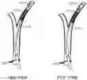 Fig. 106 - Systems and methods for treating a carotid artery