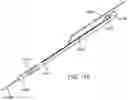 Fig. 110 - Systems and methods for treating a carotid artery