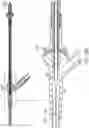Fig. 122 - Systems and methods for treating a carotid artery