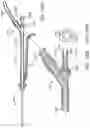 Fig. 124 - Systems and methods for treating a carotid artery