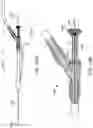 Fig. 127 - Systems and methods for treating a carotid artery