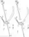 Fig. 15 - Systems and methods for treating a carotid artery