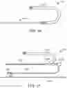 Fig. 18 - Systems and methods for treating a carotid artery