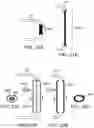 Fig. 21 - Systems and methods for treating a carotid artery