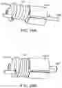 Fig. 23 - Systems and methods for treating a carotid artery