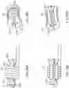 Fig. 25 - Systems and methods for treating a carotid artery