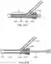 Fig. 26 - Systems and methods for treating a carotid artery