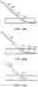 Fig. 28 - Systems and methods for treating a carotid artery