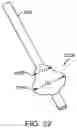 Fig. 30 - Systems and methods for treating a carotid artery