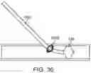 Fig. 34 - Systems and methods for treating a carotid artery