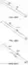 Fig. 36 - Systems and methods for treating a carotid artery