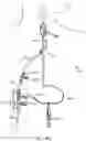 Fig. 40 - Systems and methods for treating a carotid artery