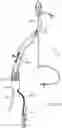 Fig. 44 - Systems and methods for treating a carotid artery