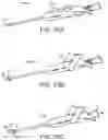 Fig. 52 - Systems and methods for treating a carotid artery