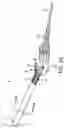 Fig. 53 - Systems and methods for treating a carotid artery