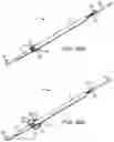 Fig. 55 - Systems and methods for treating a carotid artery