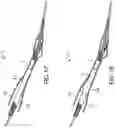 Fig. 56 - Systems and methods for treating a carotid artery