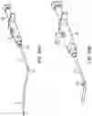 Fig. 57 - Systems and methods for treating a carotid artery