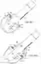 Fig. 60 - Systems and methods for treating a carotid artery