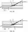 Fig. 63 - Systems and methods for treating a carotid artery