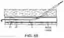 Fig. 64 - Systems and methods for treating a carotid artery