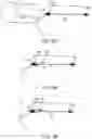 Fig. 65 - Systems and methods for treating a carotid artery