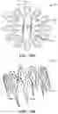 Fig. 75 - Systems and methods for treating a carotid artery