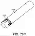 Fig. 76 - Systems and methods for treating a carotid artery