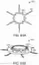 Fig. 81 - Systems and methods for treating a carotid artery