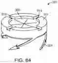 Fig. 82 - Systems and methods for treating a carotid artery