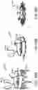 Fig. 85 - Systems and methods for treating a carotid artery